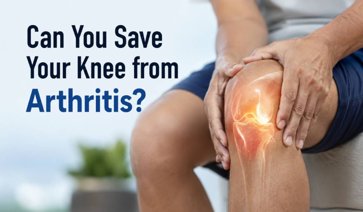 Can You Save Your Knee from Arthritis?