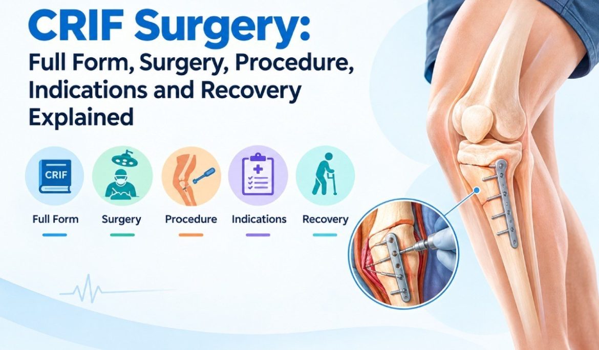 CRIF Surgery: Full Form, Surgery, Procedure, Indications and Recovery Explained